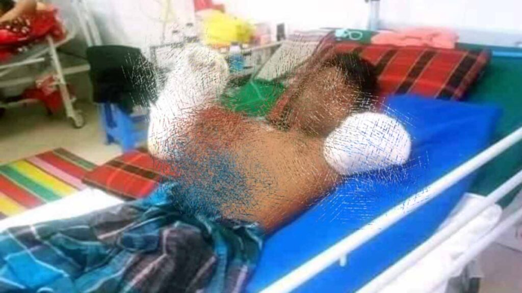 Post-accident recovery of a lineman after high-voltage electrocution