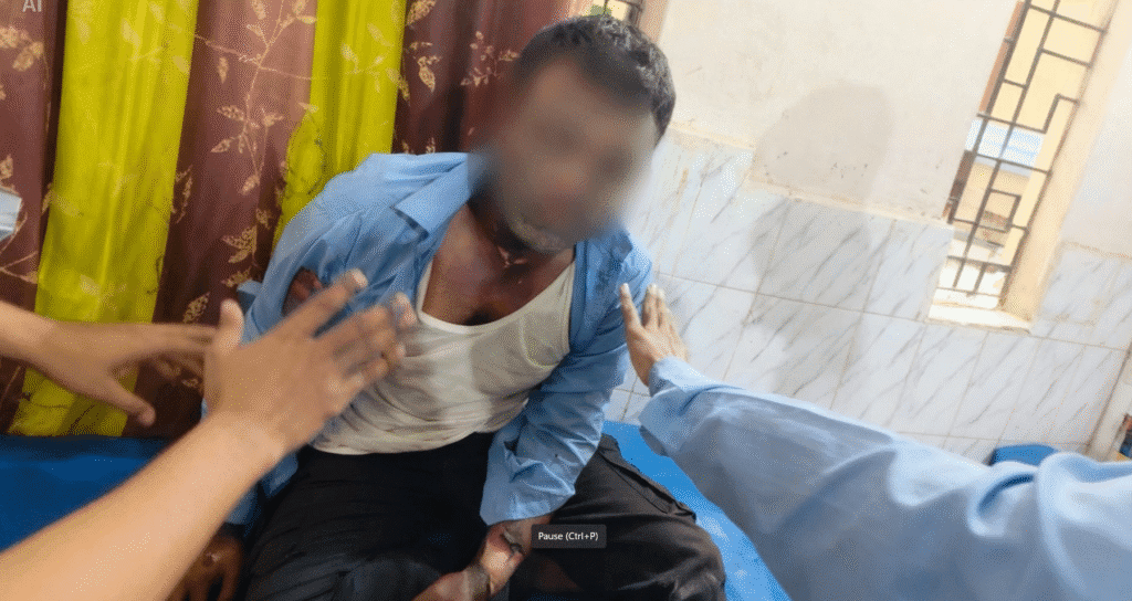 Electrical lineman burn injury safety case study